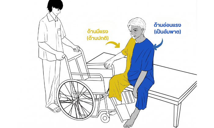 วิธีเคลื่อนย้ายผู้ป่วยติดเตียง