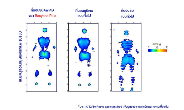 ปัญหาแผลกดทับของผู้ป่วย