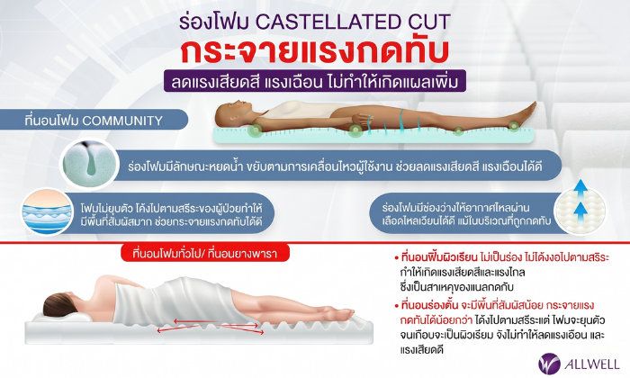 แนะนำที่นอนโฟมป้องกันแผลกดทับ